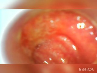 Usb endoscope 80 cm profond anal insertion, sexe film d2